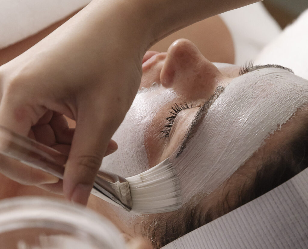 Melasma Treatments